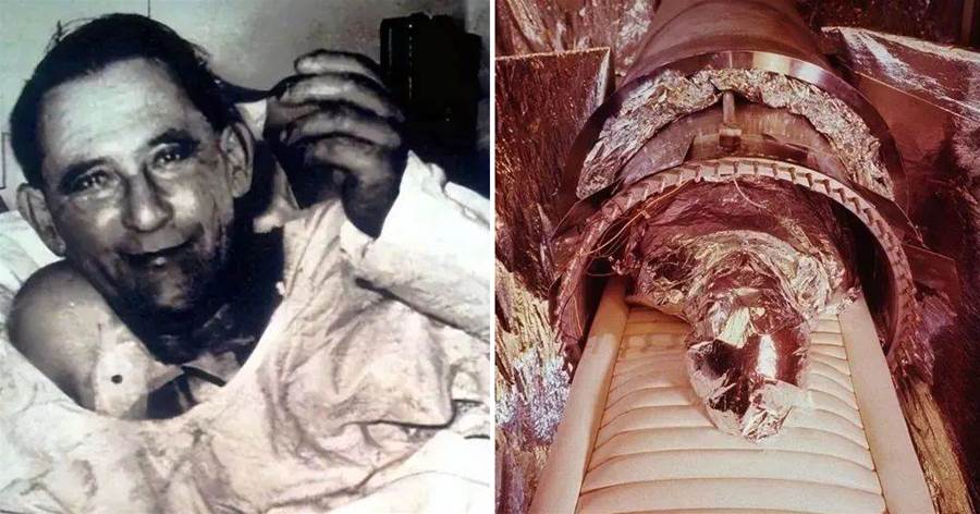 25張照片展示人類歷史上的第一次：第一位冷凍人，第一次心臟移植成功