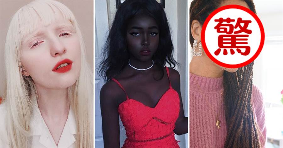 攝影師拍下6個因「膚色特殊」走紅的女孩，誰說美只有一種標準？